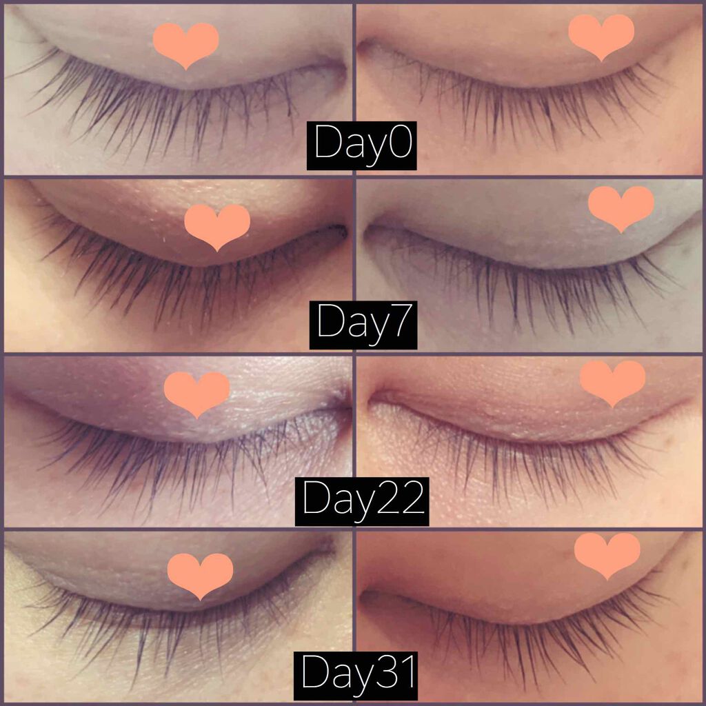 アヴァンセ ラッシュセラム EX(医薬部外品)/アヴァンセ/その他を使ったクチコミ（3枚目）