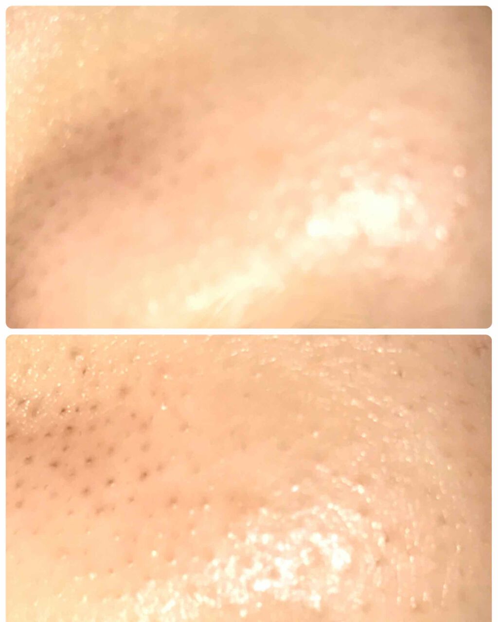 オリジナル ピュアスキンジェリー/ヴァセリン/ボディクリームを使ったクチコミ(2枚目)