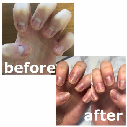 エテュセ クイックケアコート/ettusais/ネイルオイル・トリートメントを使ったクチコミ(2枚目)