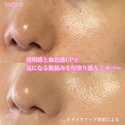 ヴェールヌーディ エッセンスパクトグロウ/AGE20’s/クリーム・エマルジョンファンデーションを使ったクチコミ(6枚目)