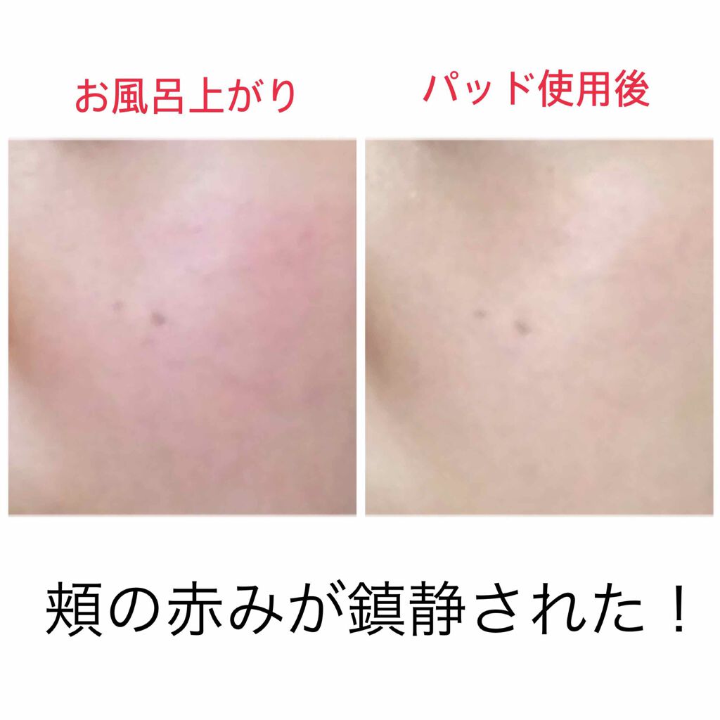 ハイポアレジェニック シカ レスキューガーゼパッド/Dermatory/シートマスク・パックを使ったクチコミ(3枚目)