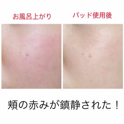 ハイポアレジェニック シカ レスキューガーゼパッド/Dermatory/シートマスク・パックを使ったクチコミ(3枚目)