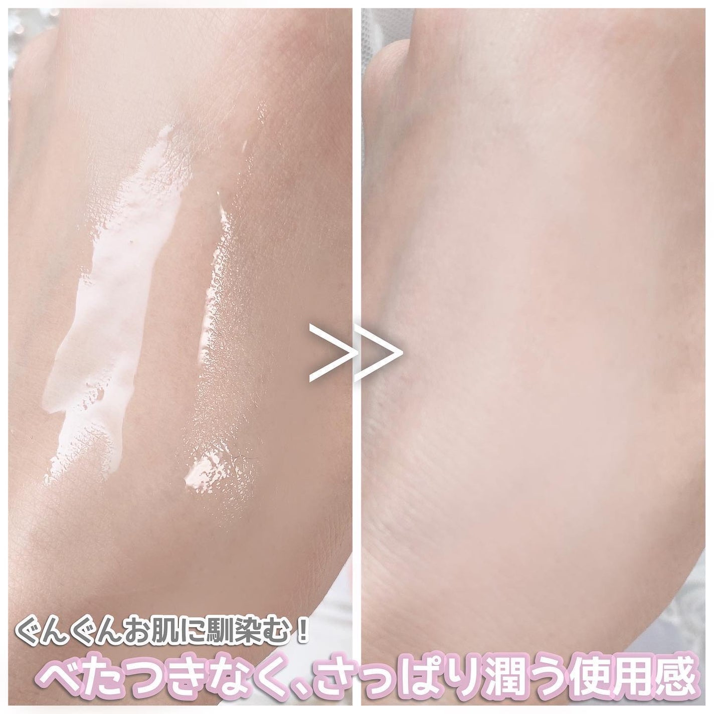 ノスカナイン トラブル セラム/FATION/美容液を使ったクチコミ(4枚目)