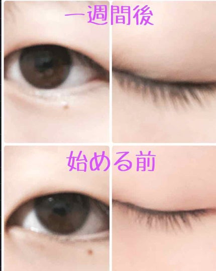 スカルプD ボーテ ピュアフリーアイラッシュセラム/アンファー(スカルプD)/まつげ美容液を使ったクチコミ(1枚目)