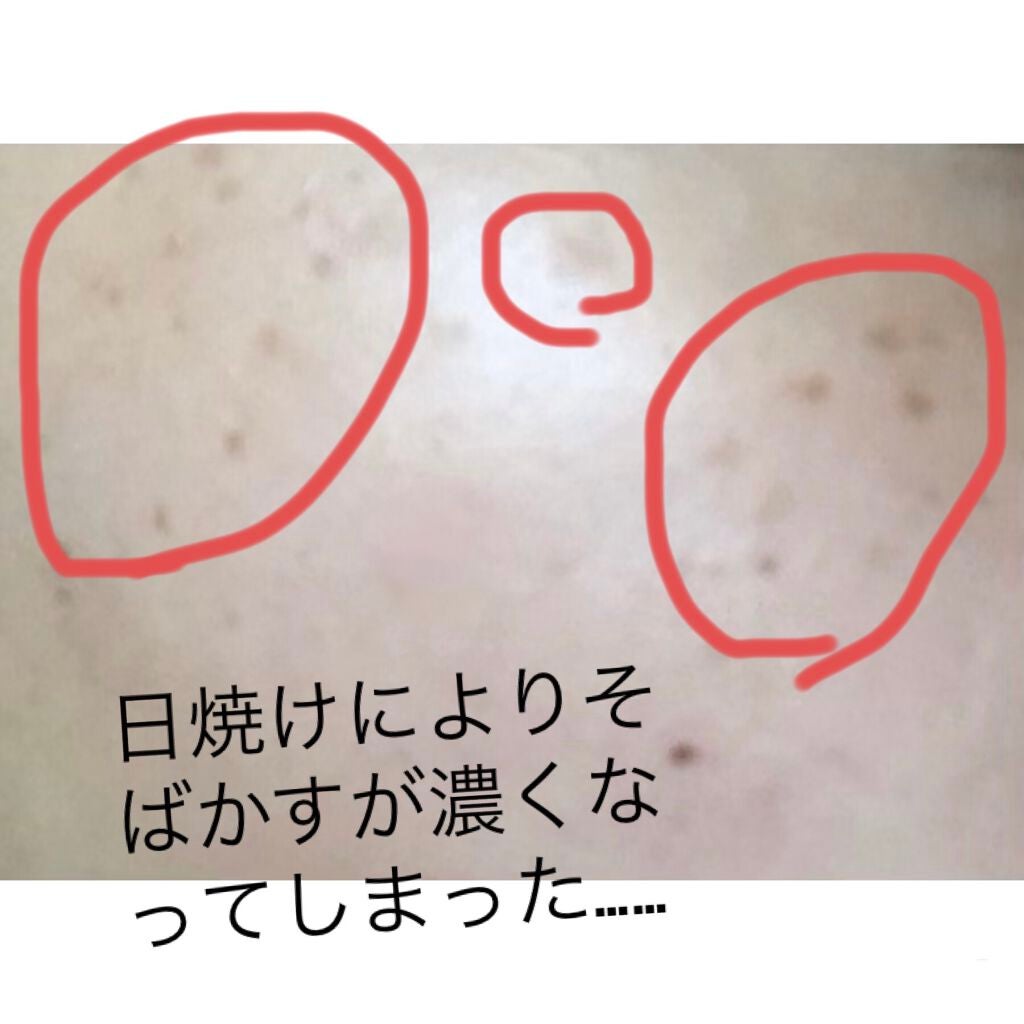 薬用 しみ 集中対策 美容液/メラノCC/美容液を使ったクチコミ(2枚目)