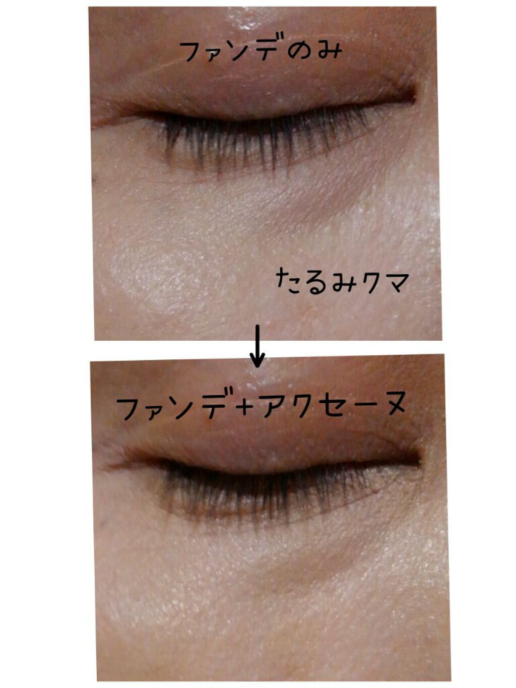 スキンカラーコントロール/ACSEINE/クリームコンシーラーを使ったクチコミ(4枚目)