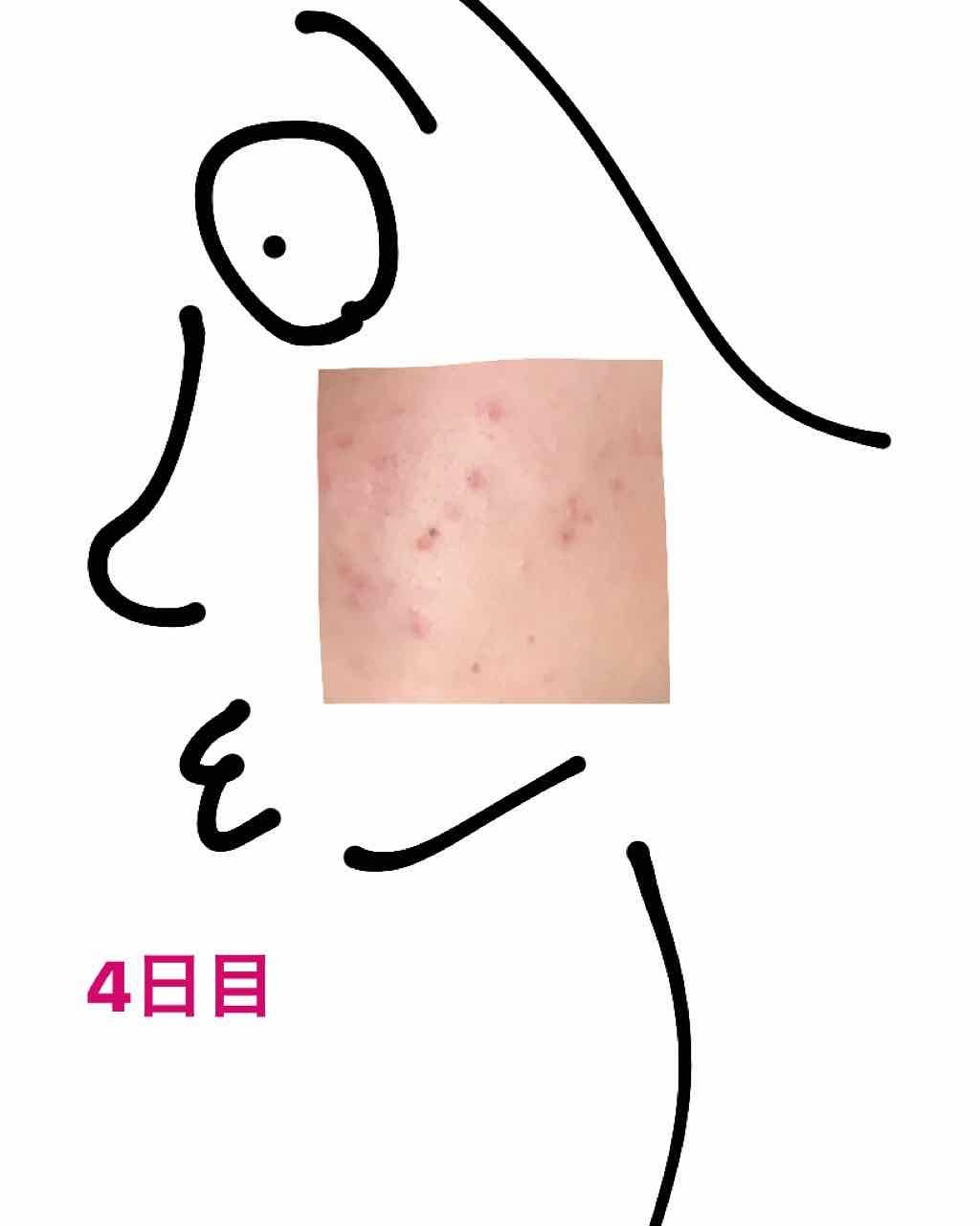 コマメ on LIPS 「4日目..」(2枚目)