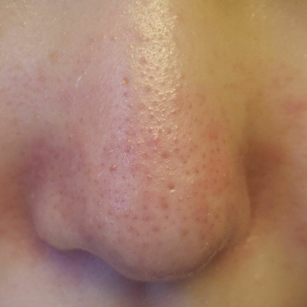 ハトムギ化粧水(ナチュリエ スキンコンディショナー R )/ナチュリエ/化粧水を使ったクチコミ（2枚目）