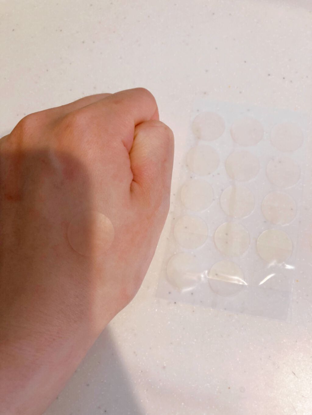 薬用ニキビケア スポッツクリーム/アクネスラボ/フェイスクリームを使ったクチコミ（3枚目）