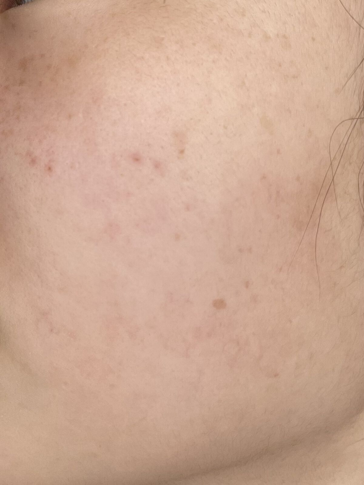 フルコートF（医薬品）/田辺三菱製薬/その他を使ったクチコミ（2枚目）