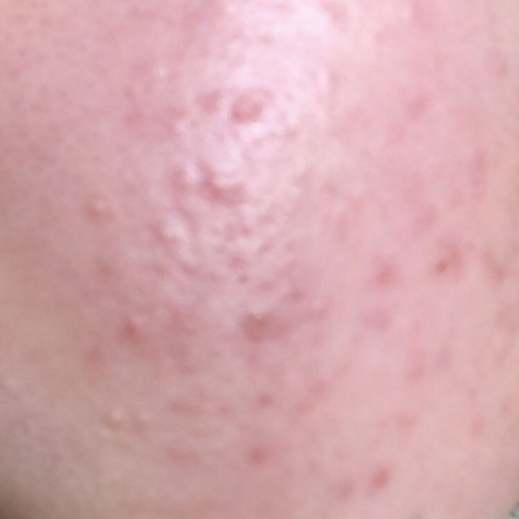 PantothenicAcid 500mg/Now Foods/健康サプリメントを使ったクチコミ（1枚目）