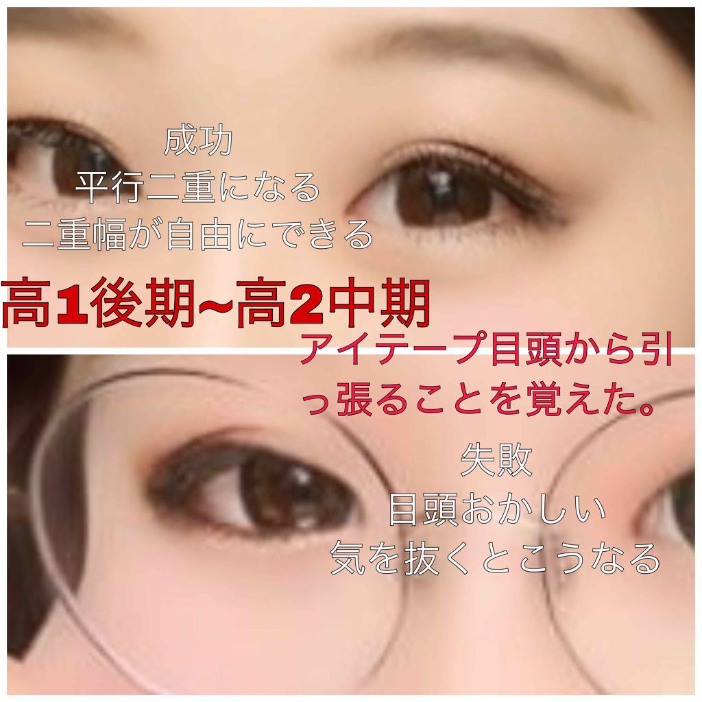 のびーるアイテープ(絆創膏タイプ、レギュラー)/DAISO/二重まぶた用アイテムを使ったクチコミ(3枚目)