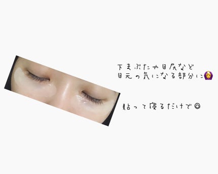 ナチュラベーレ THEマイクロニードル/ナチュラベーレ/シートマスク・パックを使ったクチコミ(4枚目)