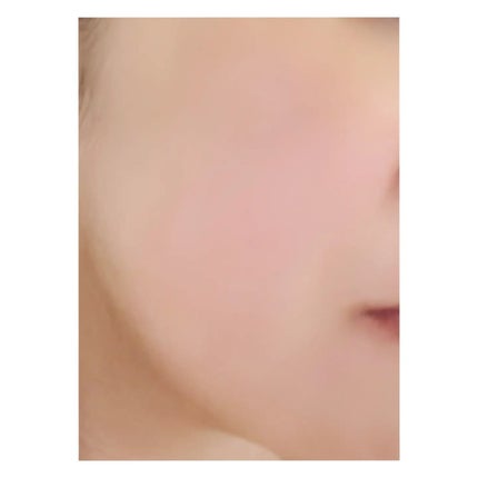 リズム べース ポイント集中パック(シャイン)/RISM/シートマスク・パックを使ったクチコミ(4枚目)