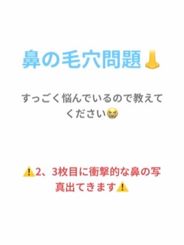 オリジナル ピュアスキンジェリー/ヴァセリン/ボディクリームを使ったクチコミ（1枚目）