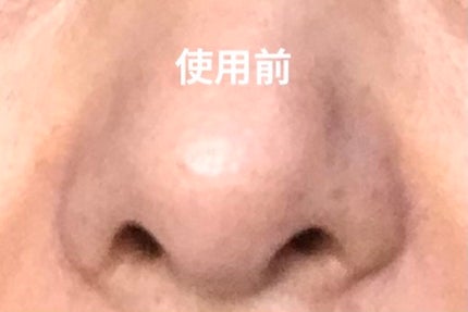 いいじゃんガスール石鹸/イーキューブ/洗顔石鹸を使ったクチコミ(3枚目)