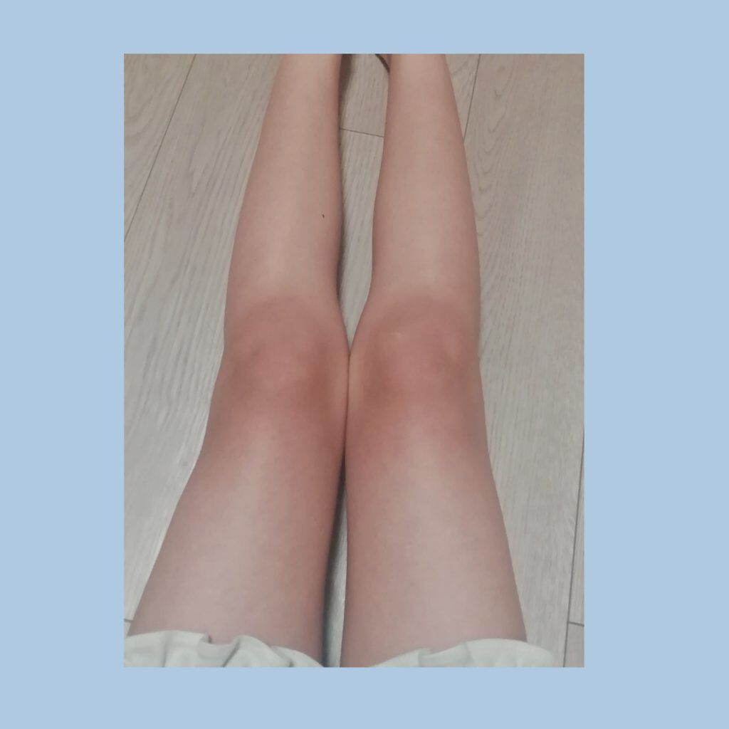 薬用しみ対策 美白化粧水 しっとりタイプ/メラノCC/化粧水を使ったクチコミ（2枚目）