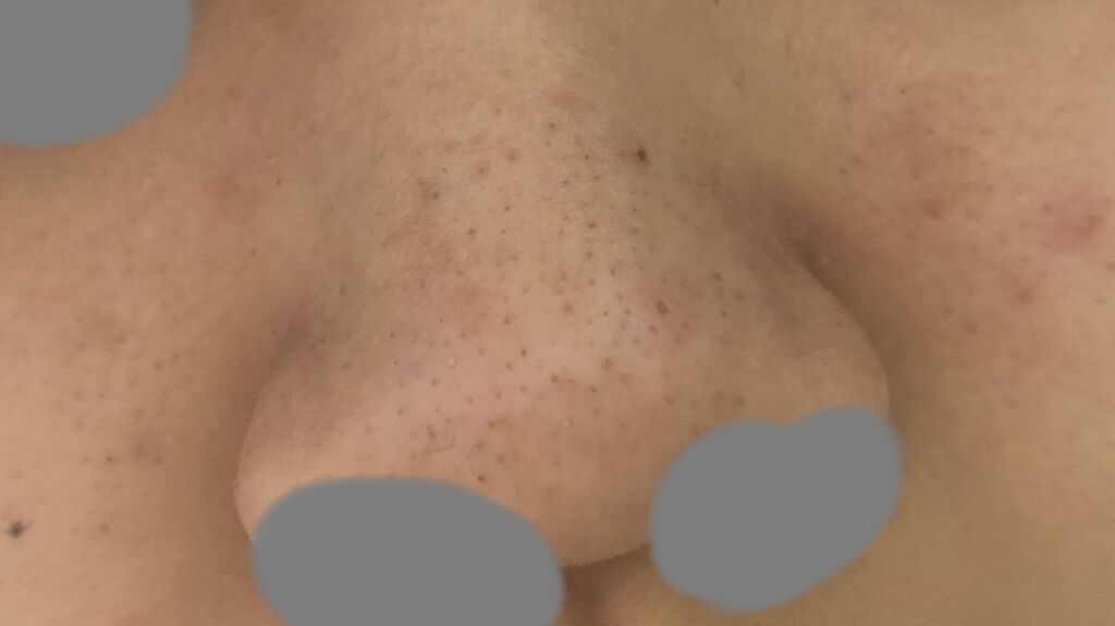 ドット・ウォッシー洗顔石鹸/ペリカン石鹸/洗顔石鹸を使ったクチコミ（2枚目）