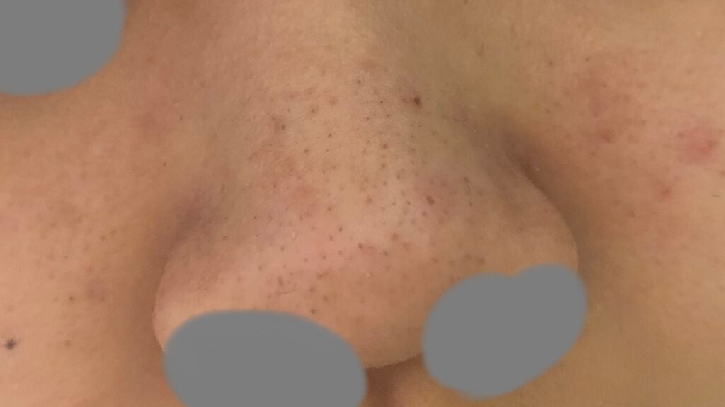 ドット・ウォッシー洗顔石鹸/ペリカン石鹸/洗顔石鹸を使ったクチコミ(2枚目)