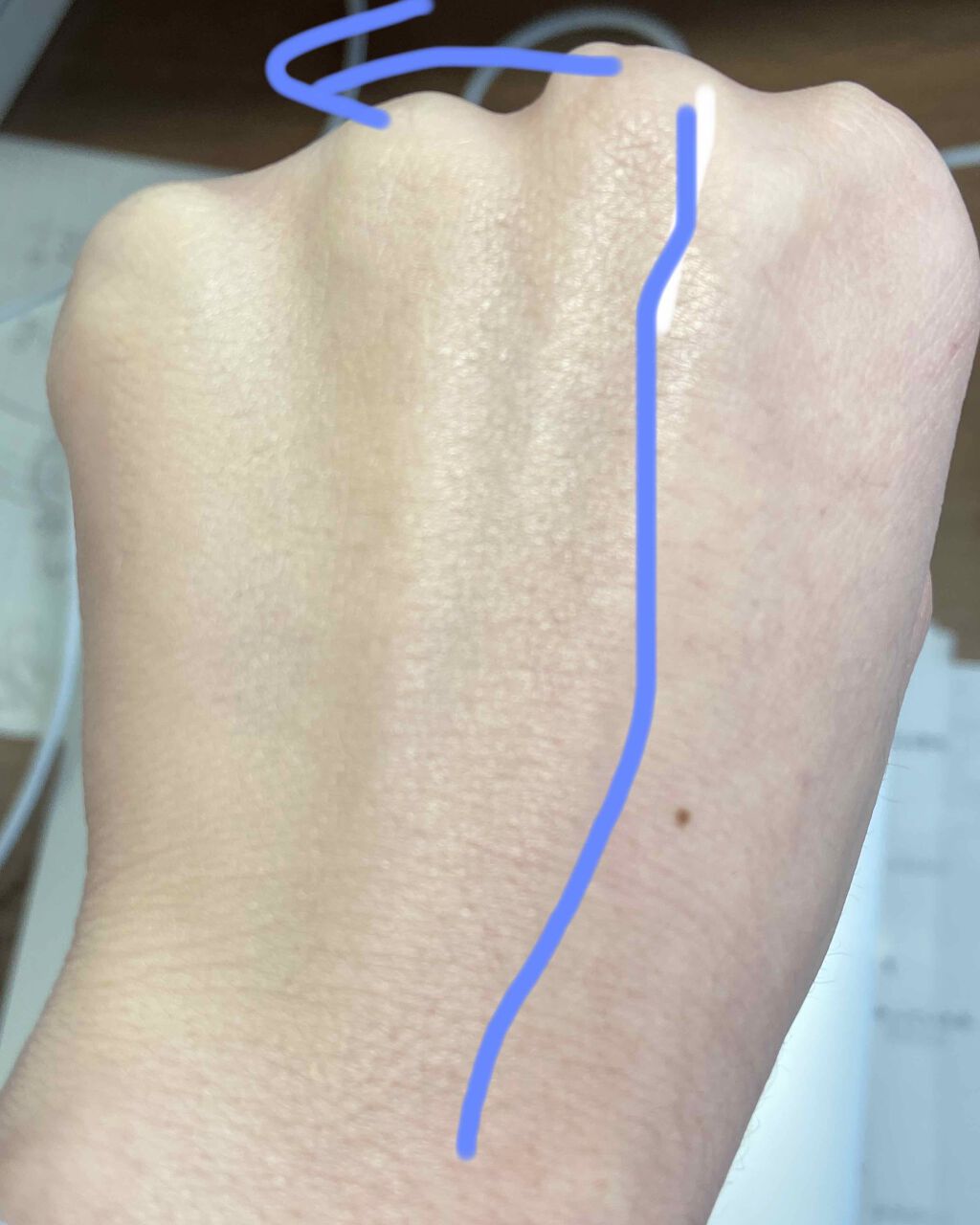 ドクタージャルト シカペア リカバー (第2世代）/Dr.Jart＋/フェイスクリームを使ったクチコミ（3枚目）