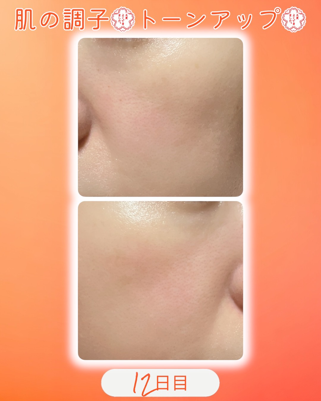 TXトーニングデイリーマスク/VT/その他スキンケアを使ったクチコミ（2枚目）