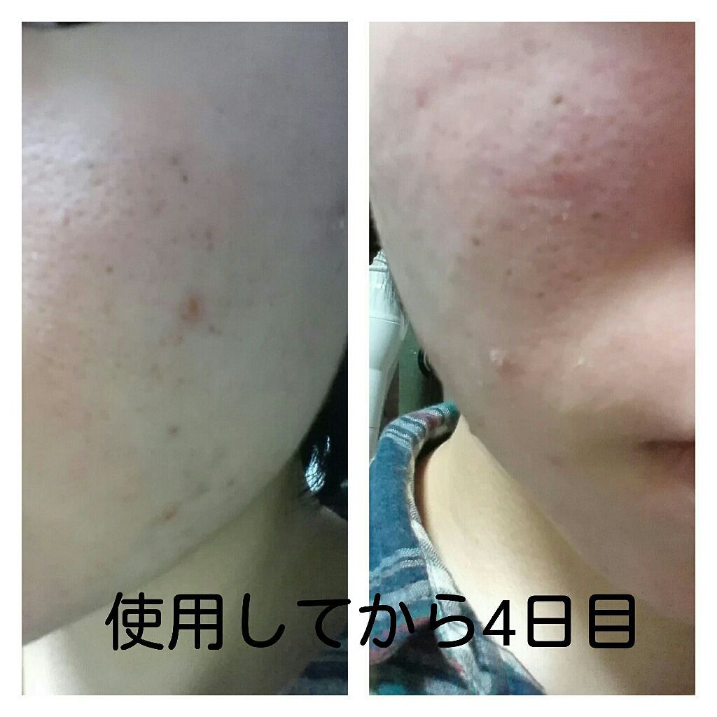 銀麦 on LIPS 「今回は株式会社イーズ・インターナショナルさんの「夜だけ美容断食..」(4枚目)