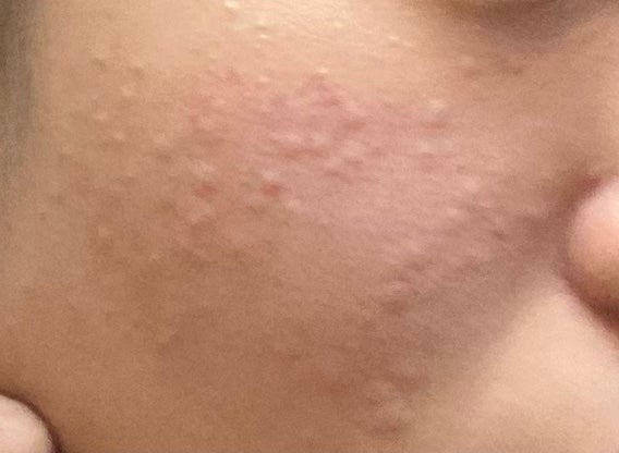 おうちdeエステ 肌をやわらかくする マッサージ洗顔ジェル /ビオレ/その他洗顔料を使ったクチコミ(2枚目)