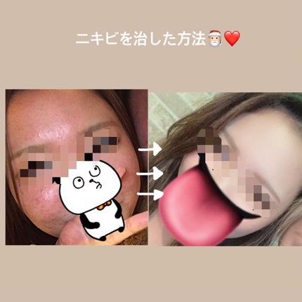 青箱 (さっぱり)/カウブランド/ボディ石鹸を使ったクチコミ(1枚目)