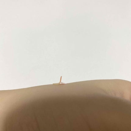 Nexcare/3M nexcare/にきびパッチを使ったクチコミ(4枚目)