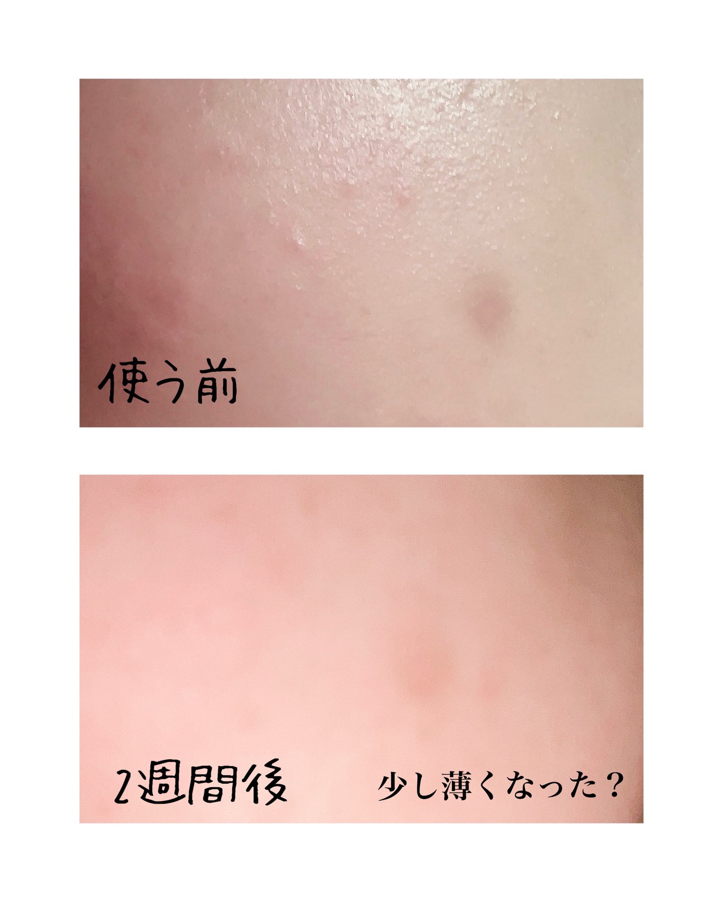 5番 白玉グルタチオンC美容液/numbuzin/美容液を使ったクチコミ(3枚目)