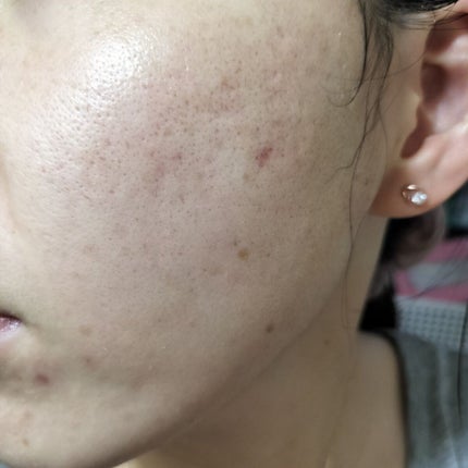 を使ったクチコミ(2枚目)