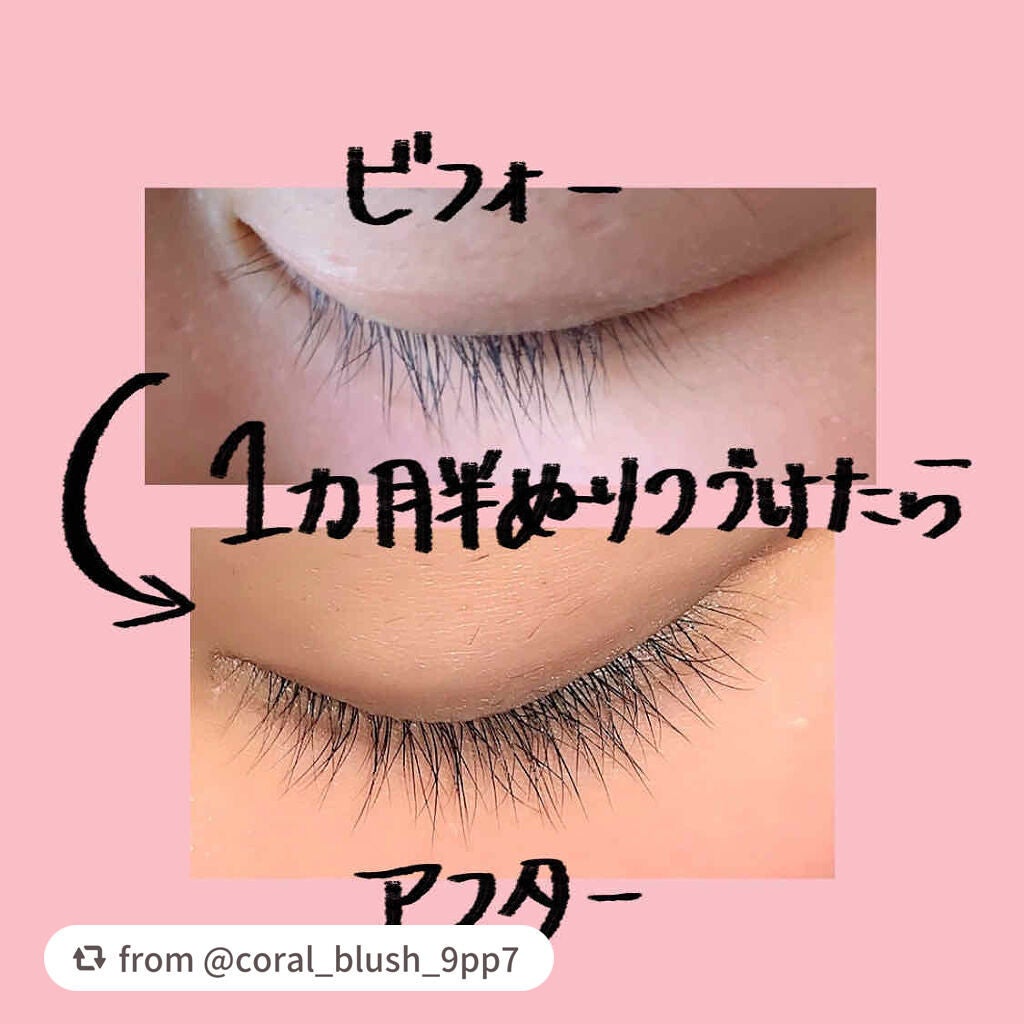 スカルプD ボーテ ピュアフリーアイラッシュセラム プレミアム/アンファー(スカルプD)/まつげ美容液を使ったクチコミ(2枚目)