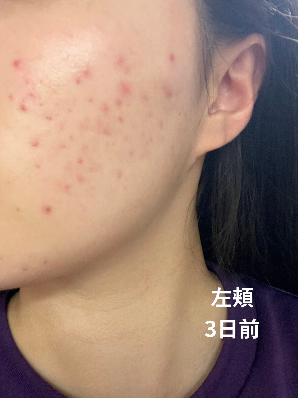 皮脂トラブルケア 保湿ジェル/キュレル/化粧水を使ったクチコミ(4枚目)