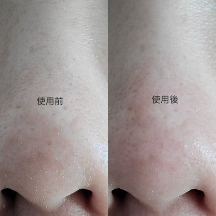 ワンデイズユー ディープクレンジグオイル/One-day's you/オイルクレンジングを使ったクチコミ(4枚目)