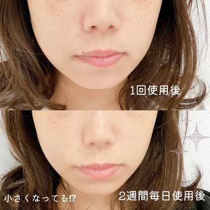 Fornez(フォーネス)/LUXCEAR/美顔器・マッサージを使ったクチコミ(4枚目)