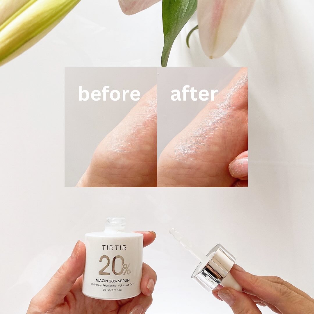 NIACIN 20% セラム/TIRTIR(ティルティル)/美容液を使ったクチコミ（2枚目）