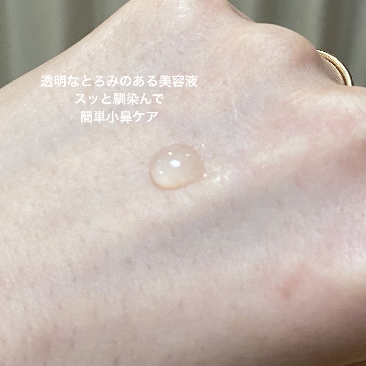 薬用 アクネケア美容液/d プログラム/美容液を使ったクチコミ（2枚目）