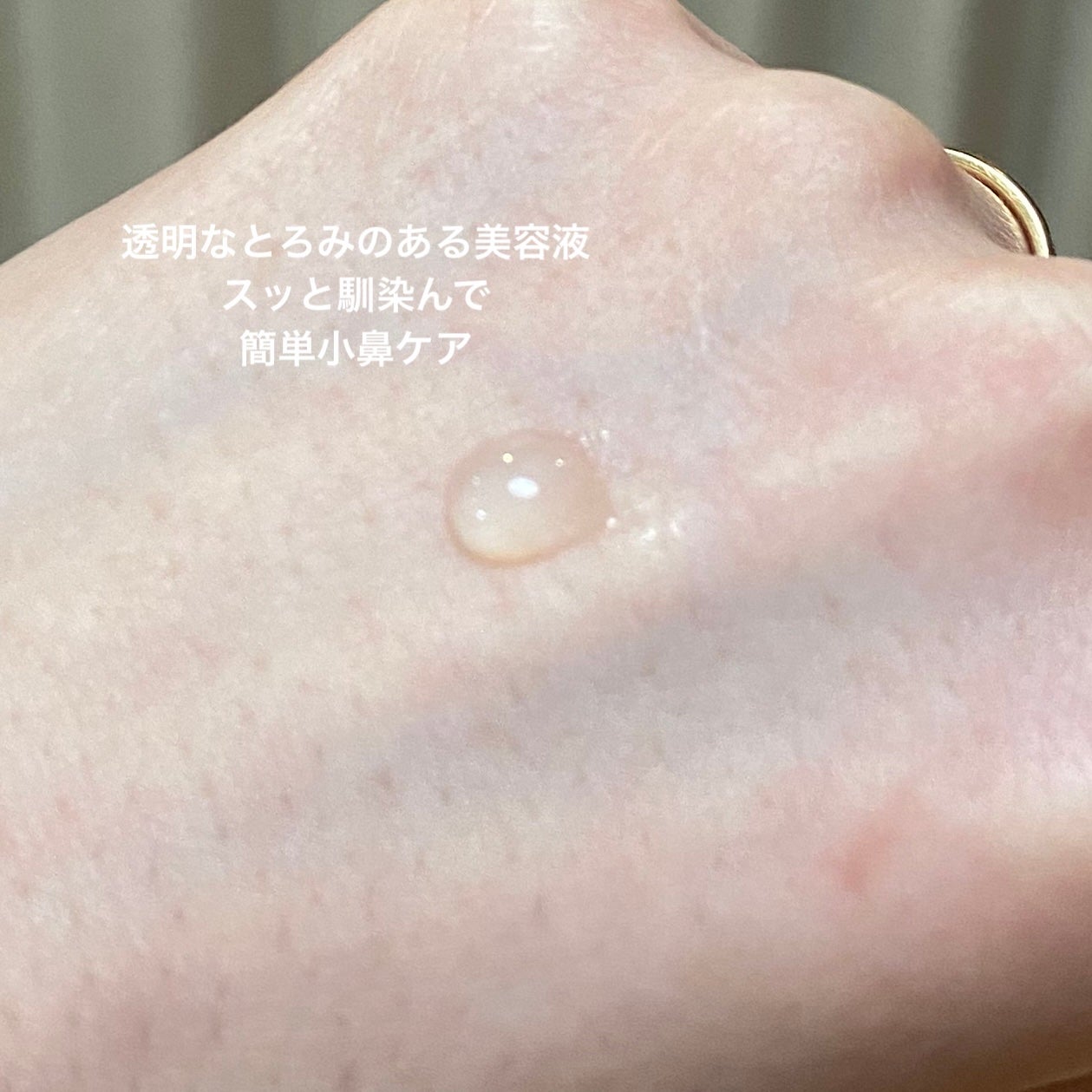 薬用 アクネケア美容液/d プログラム/美容液を使ったクチコミ(2枚目)