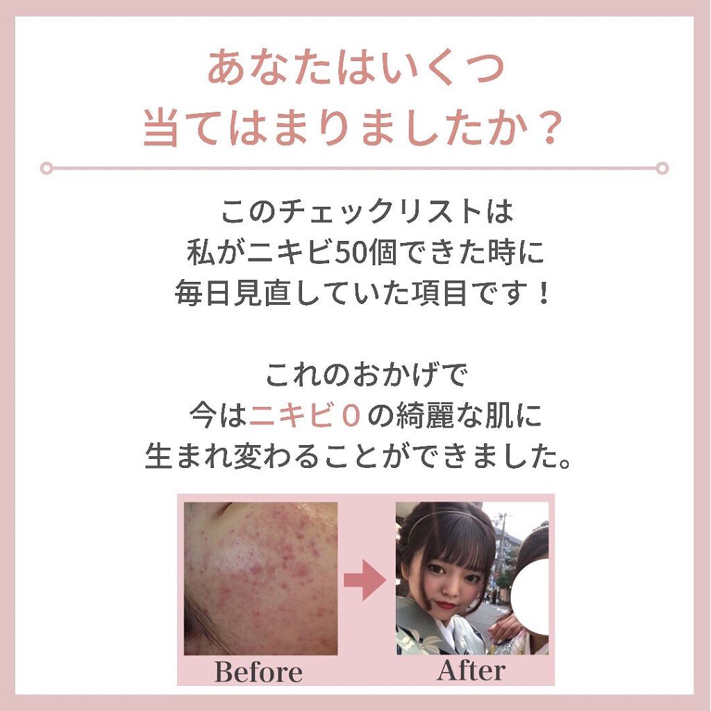 myu eruðïŸïœïœ°ïœŽïŸ on LIPS ãæ¯æ¥æçš¿53æ¥ç®ð¹ä»ã®æçš¿ããã§ãã¯ðð»@kirakira_s..ãïŒ2æç®ïŒ