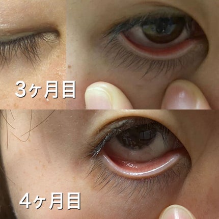 スカルプD ボーテ ピュアフリーアイラッシュセラム/アンファー(スカルプD)/まつげ美容液を使ったクチコミ(2枚目)