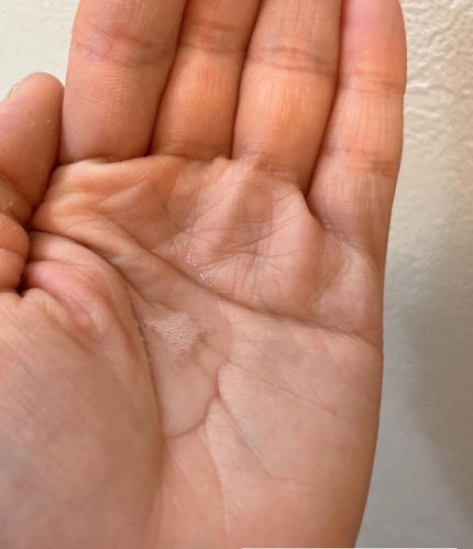 薬用マイクロバブルローション/Macchia Label/化粧水を使ったクチコミ(5枚目)