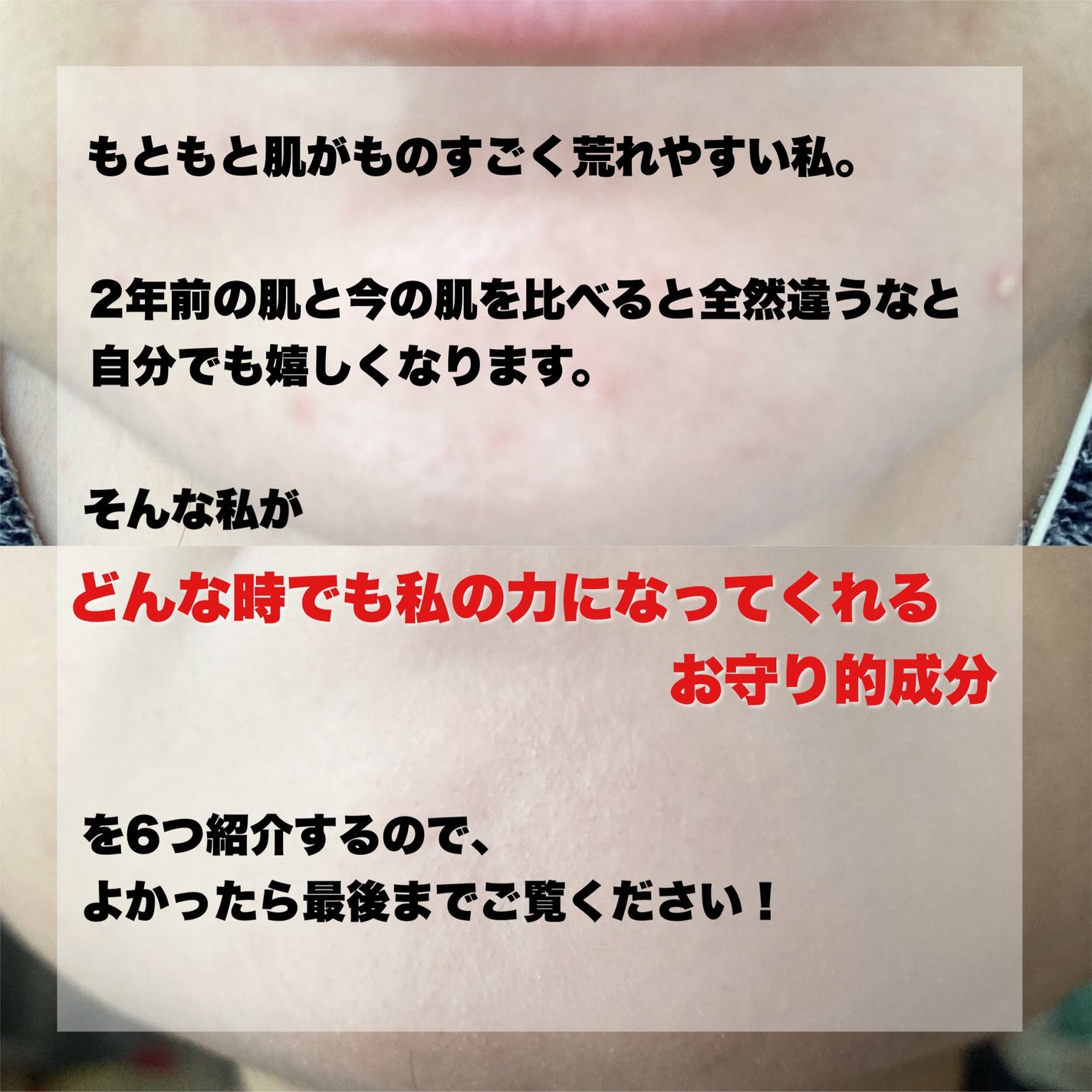 ボディミルク ブライトニング&エイジングケア<医薬部外品>/ファンケル/ボディミルクを使ったクチコミ(2枚目)