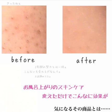 ハトムギ化粧水(ナチュリエ スキンコンディショナー R )/ナチュリエ/化粧水を使ったクチコミ(2枚目)