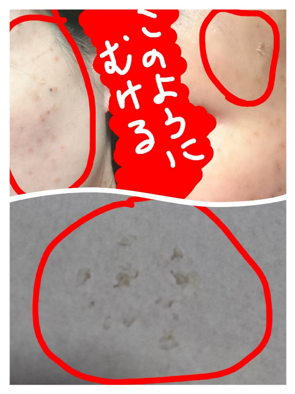 ブライトニングフォーミュラ/メコゾーム/フェイスクリームを使ったクチコミ(4枚目)