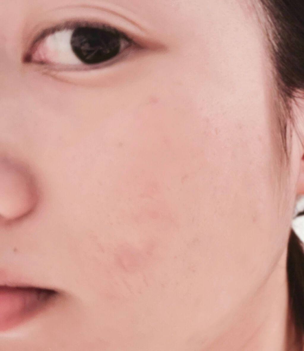 ソフトマットコンプリート ファンデーション/NARS/リキッドファンデーションを使ったクチコミ(4枚目)