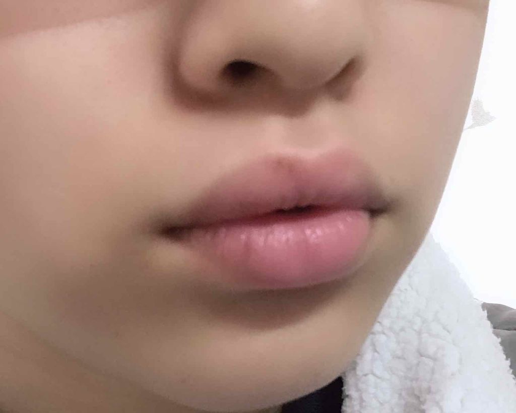 オリジナル ピュアスキンジェリー/ヴァセリン/ボディクリームを使ったクチコミ(3枚目)