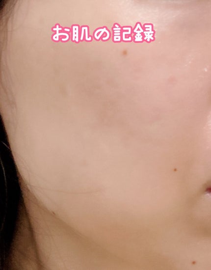 ホワイトアップ ローション(II)/アクアレーベル/化粧水を使ったクチコミ(1枚目)