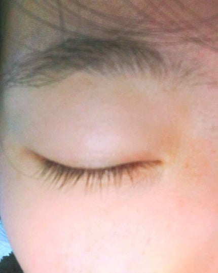 アヴァンセ ラッシュセラム EX(医薬部外品)/アヴァンセ/その他を使ったクチコミ(2枚目)