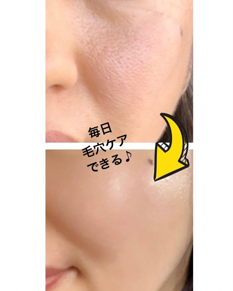 グルタシカ ブライトニングクイックマスク/Dr.Viuum/シートマスク・パックを使ったクチコミ(4枚目)