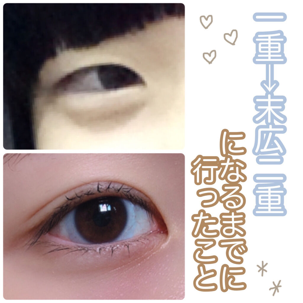 両面アイテープレギュラー/DAISO/二重まぶた用アイテムを使ったクチコミ（1枚目）